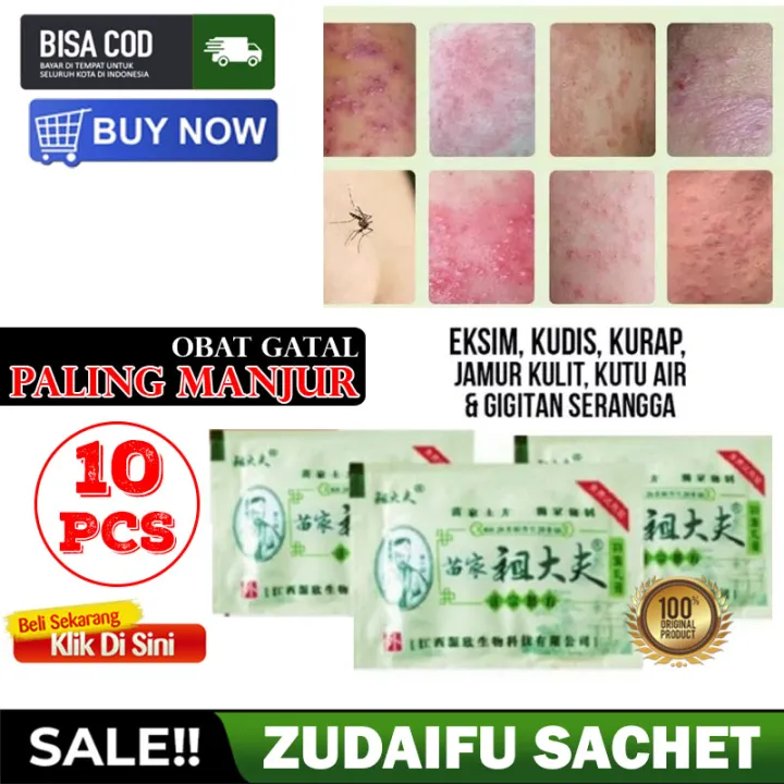 Zudaifu Salep Gatal Krim Cream Obat Herbal China Produk Perawatan