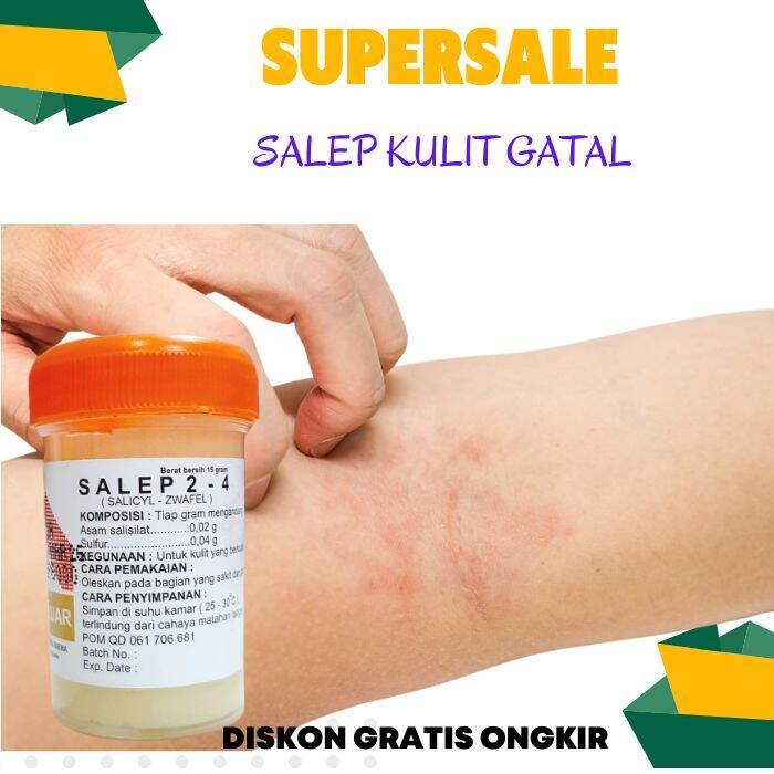 Zwavel Salep Gatal Selangkangan Ampuh Bpom Cream Gatel Bokong Zwafel