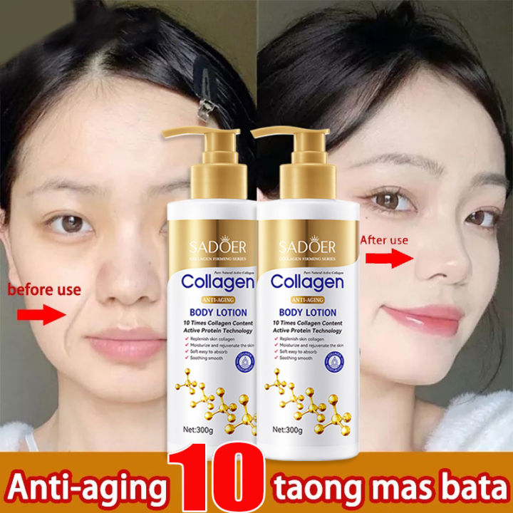 100 Very Effective Original SADOER Beauty Kojic Acid Body Lotion With