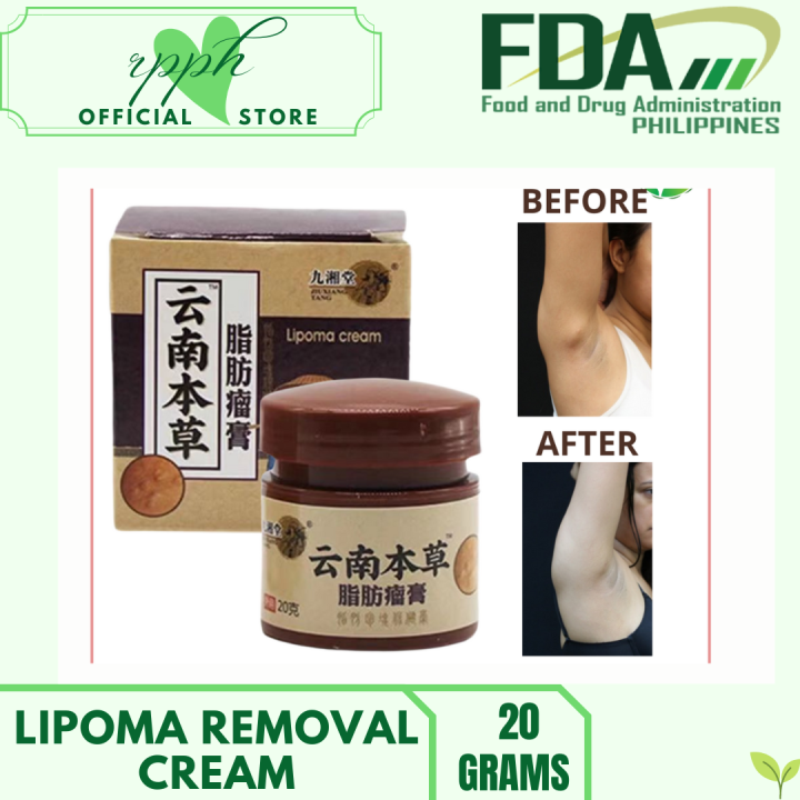 Buy Now Lipoma Removal Cream Treat Tumor Skin Swelling Ointment