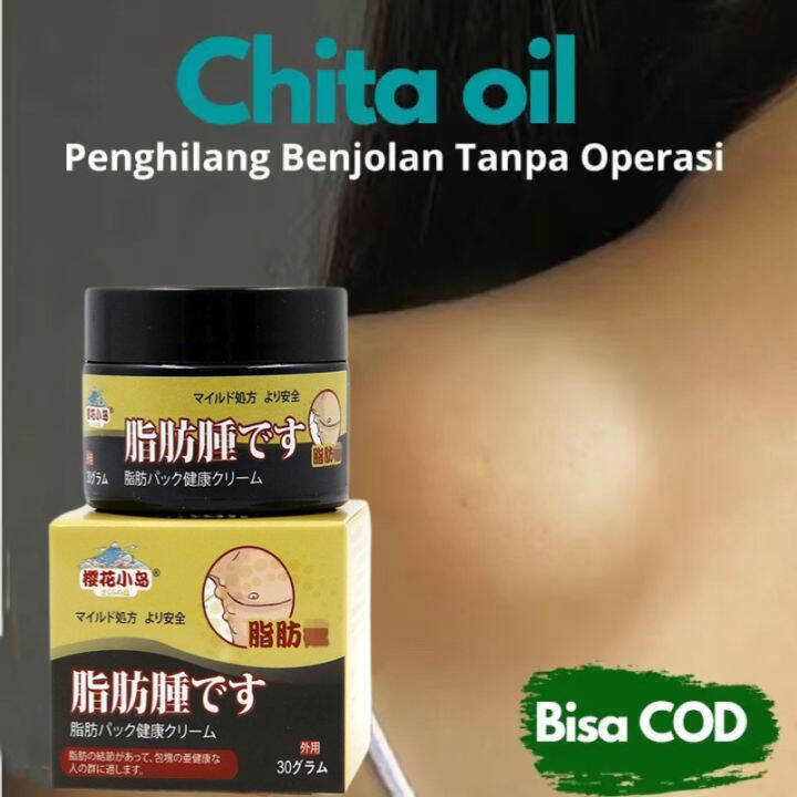 30g Krim Penghilang Lipoma Cream Kelkelenjar Benjoran Lipoma Lipoma