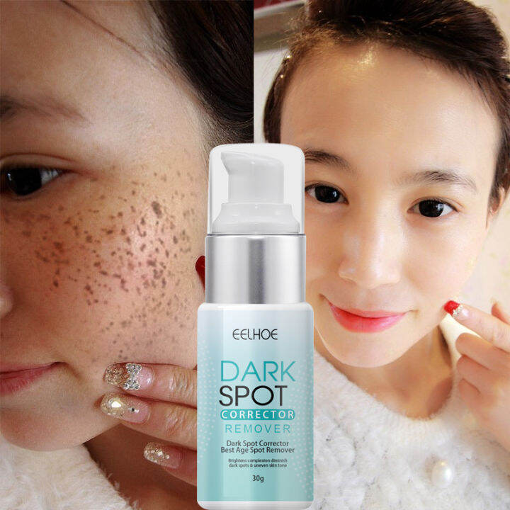 Eelhoe Dark Spot Remover Cream Moisturizing Brighten Improving Uneven