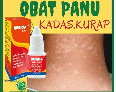 Resida Cair Seperti Kalpanax Cair Obat Kulit Untuk Panu Kadas Kurab