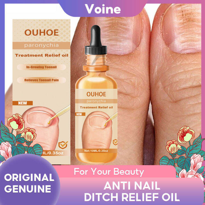 Ouhoe Anti Nail Groove Relief Oil For Repairing Ingrown Toenails Gray