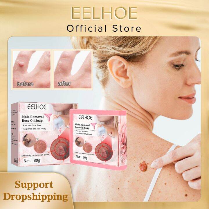 Eelhoe Mole Removal Rose Oil Soap Deep Cleaning Body Skin Tags Mole