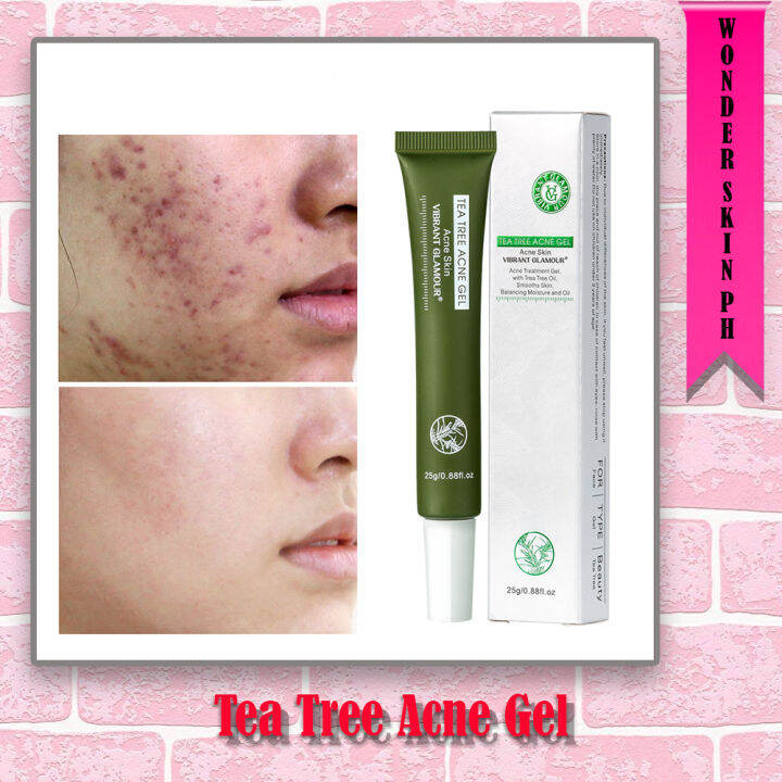 Vibrant Glamour Tea Tree Acne Gel Acne Spot Scar Tea Tree For Facial