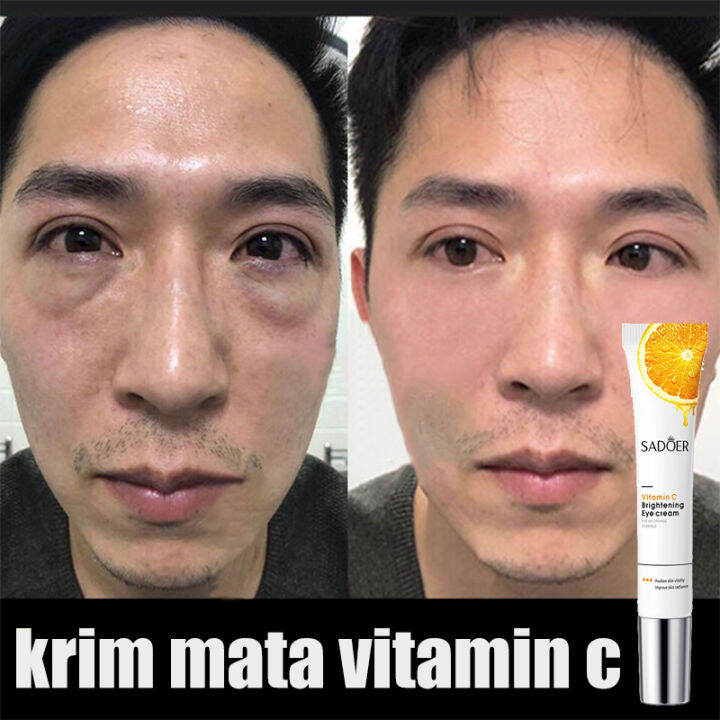 Eye Cream Krim Mata Vitamin C Cream Penghilang Kantung Mata Garis Halus