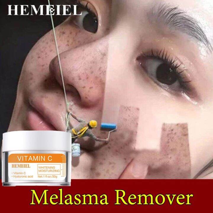 MEIEL Melasma Cream Pekas Remover Super Collagen Japan Super Collagen