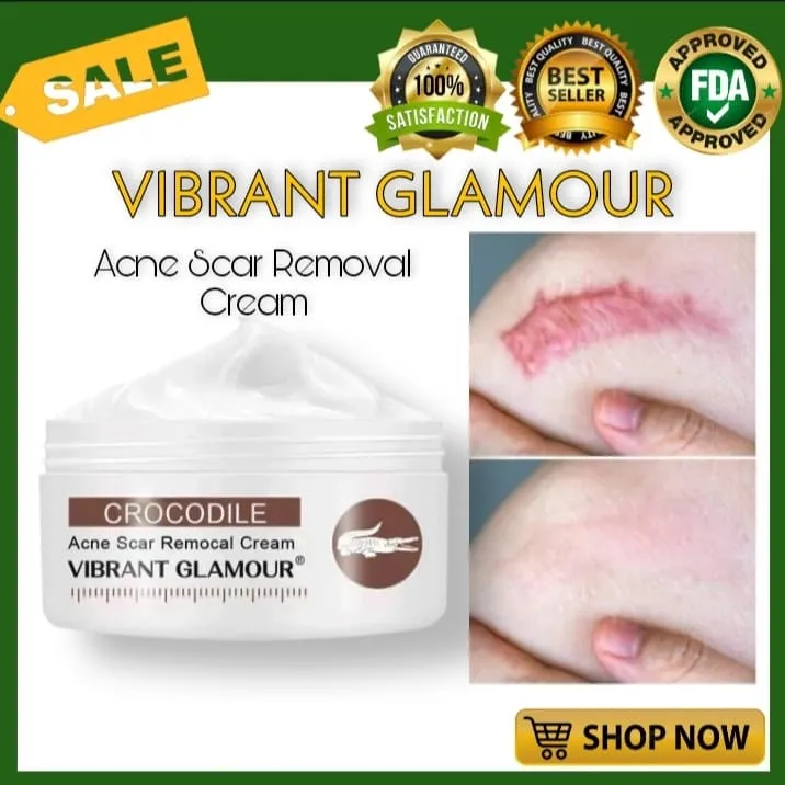 Authentic Vibrant Glamour Crocodile Scar Cream For Old Scars Stretch