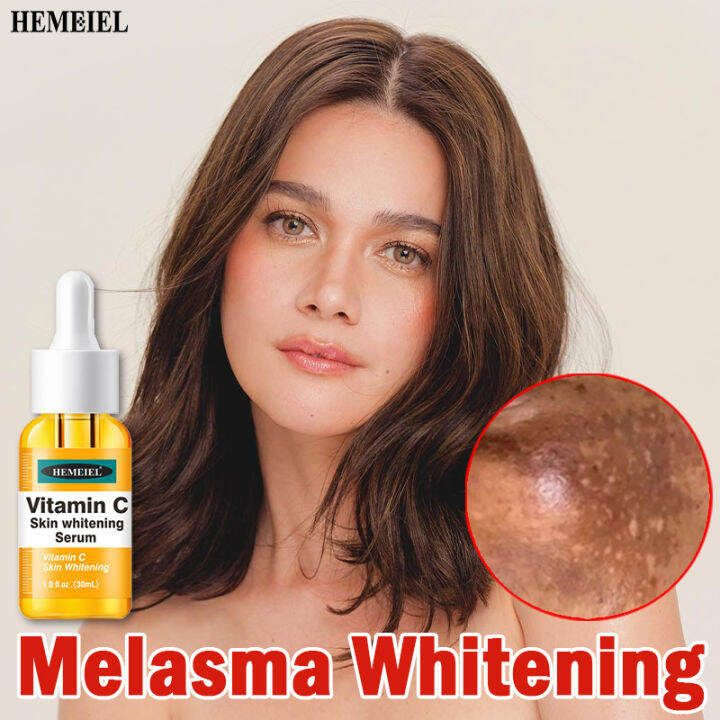 HEMEIEL Vitamin C Serum Melasma And Pekas Remover Dark Spots Whitening