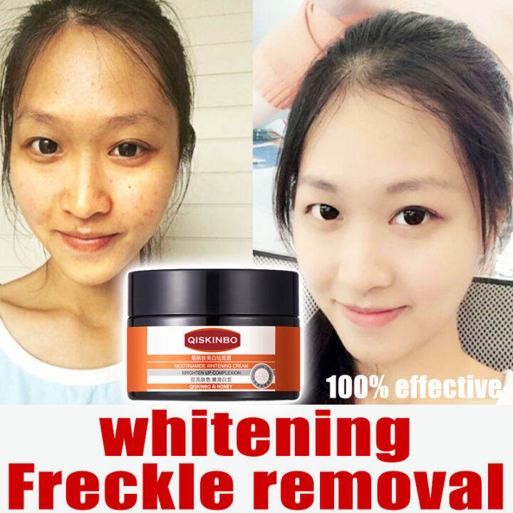 Whitening Freckle Dark Spot Remover Melasma Removal Cream Original