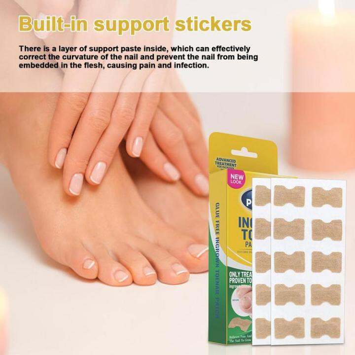 Nail Correction Stickers Ingrown Toenail Corrector Patches Glue Free