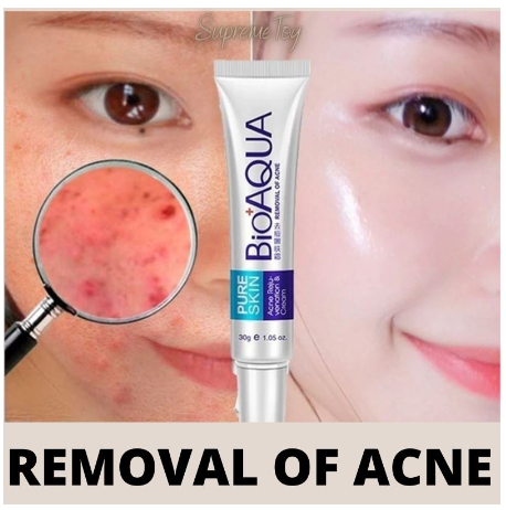 Bioaqua Pure Cream Skin Removal Or Acne Prone Removal G Lazada Ph