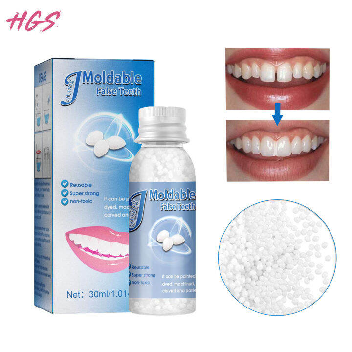 HGS 30ml Temporary Tooth Repair Kit Teeth And Gaps Moldable Falseteeth