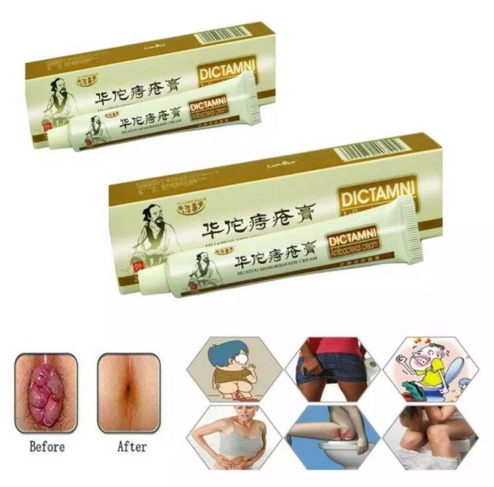 Buy Take Hemorrhoids Ointment Cream Chinese Medicine Huatuo Shrink