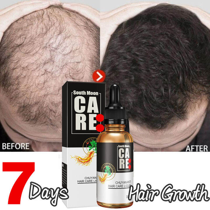 Days Hair Grower Serum X Faster Long Hair Minoxidil Hair Grower