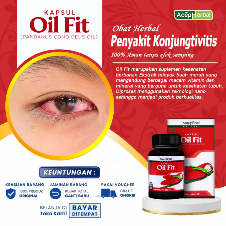 Obat Mata Gatal Pruritus Ocular Alergi Mata Iritasi Mata Infeksi