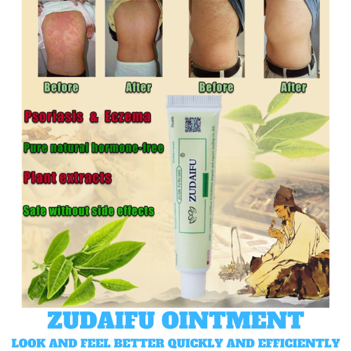 Zudaifu Cream Original Miracle Cream Ointment For Allergy Itchy Skin