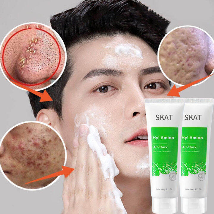 Hy Amino AC Ttack Anti Acne Facial Wash 100g Amino Acid Facial Cleanser