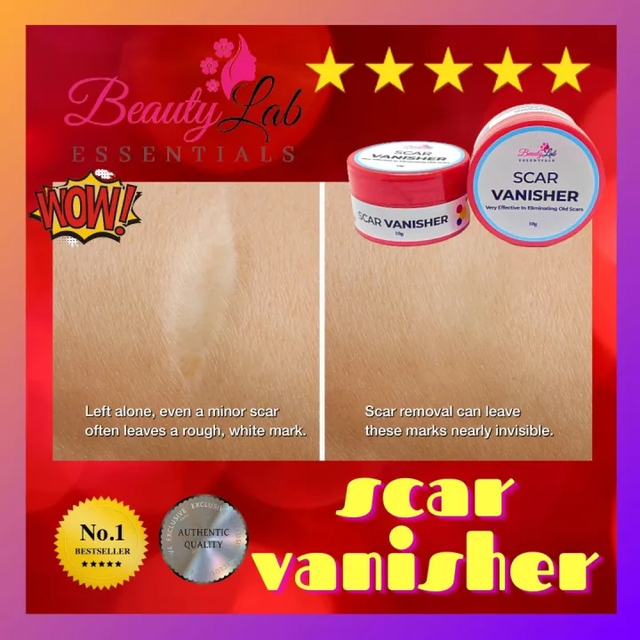 BEAUTY LAB ESSENTIALS SCAR VANISHER SCAR REMOVER 10 GRAMS Suitable For