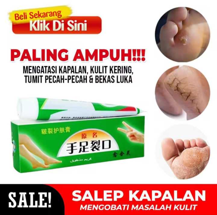 Salep Ijo Kaki Pecah Pecah Kering Tumit Rangen Rayapan Lotion Kaki