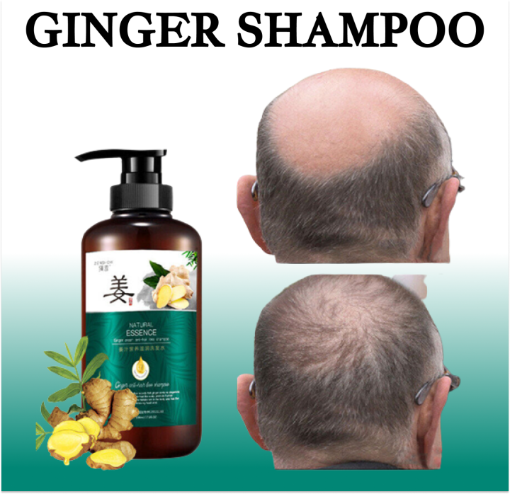 Ml Ginger Hair Grower Shampoo Anti Dandruff Shampoo Anti Hair Loss