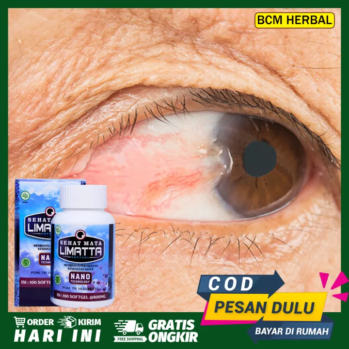 Obat Gumpalan Lemak Mata Pterigium Pterygium Mata Berlemak Berasap