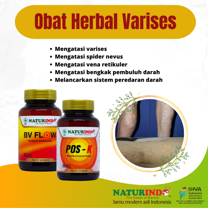 Obat Herbal Varises Farises Spider Nevus Vena Retikuler Bengkak Pembulu