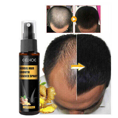 Eelhoe Herbal Hair Growth Essence Spray Advanced Hair Grower Treatment