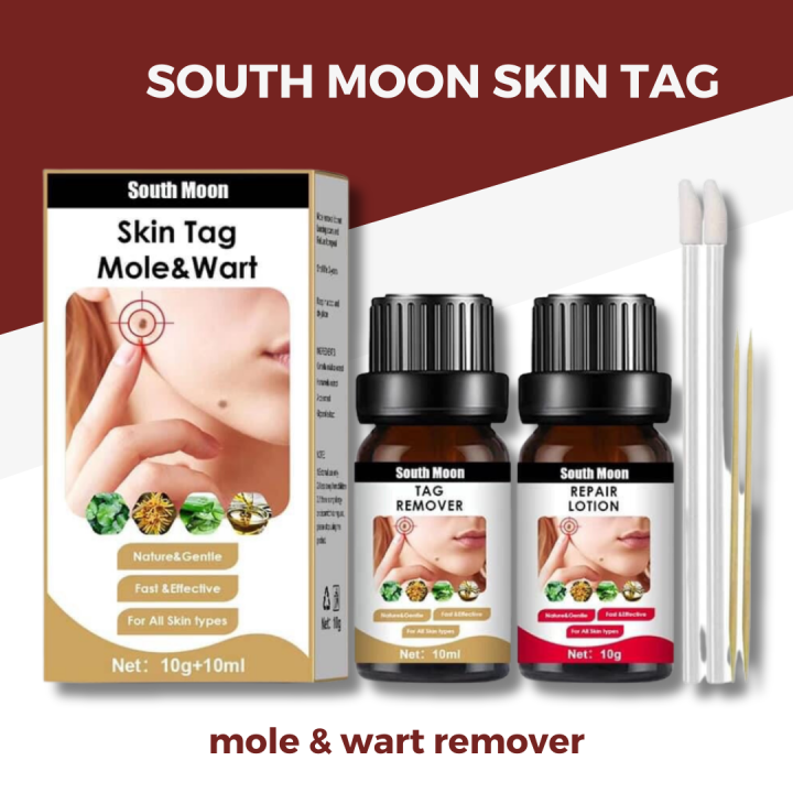 South Moon Skin Tag Mole And Wart Skin Dark Spot For Callus Remover