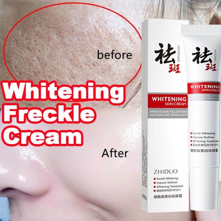 ZHIDUO Melasma Cream Dark Spot Remover Whitening Freckle Cream Brighten