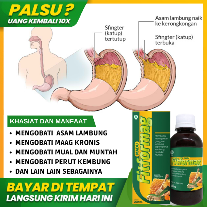 Obat Asam Lambung Paling Ampuh Gerd Dispepsia Gastritis Tukak Lambung