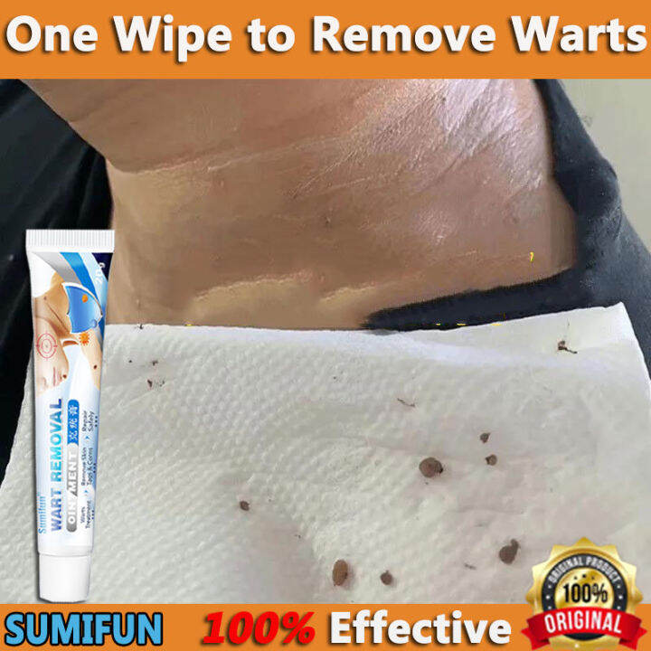 Original Sumifun Warts Remove Cream G Herbal Extract Safe And