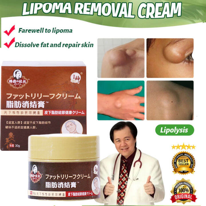 Imported From Japan Lipoma Removal Cream 30g Skin Lumps Dredge