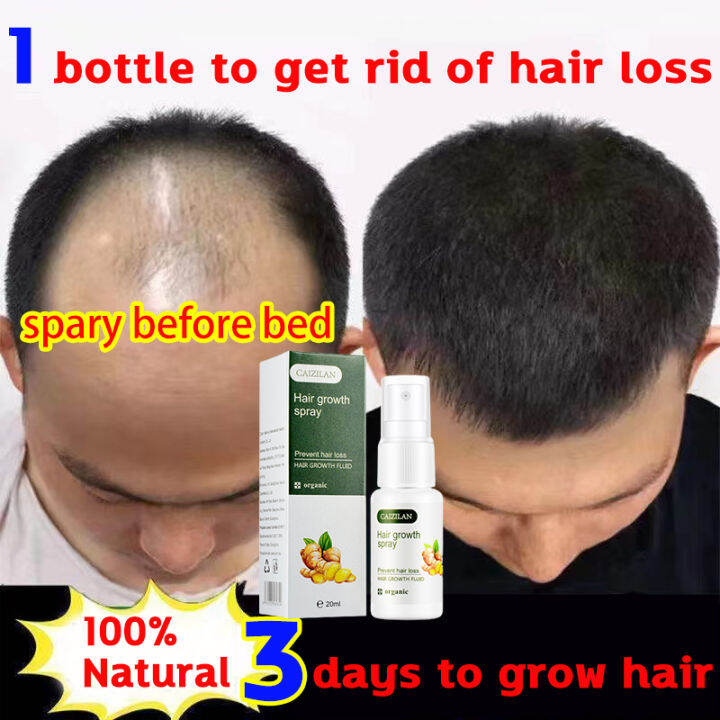 3 Days Repair CZL Hair Growth Spray 20ML Fast Powerful Hair Grower Hair