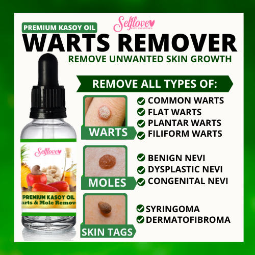 Mole Warts Remover Original Cream Warts And Skin Tags Remover Serum