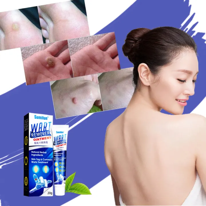 Sumifun Original Warts Remover Cream Ointment G Painless Removal Of