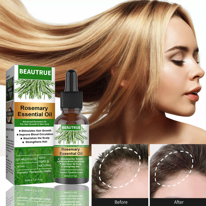 EELHOE Rosemary ESSENTIAL Oil Hair Growth Anti Hair Loss Lazada PH