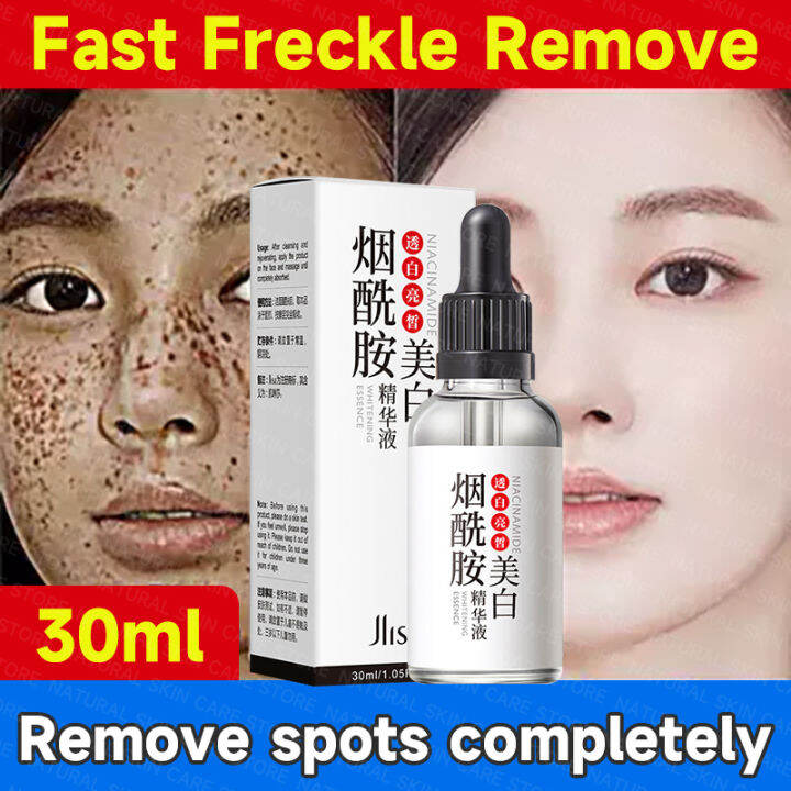 Whitening Serum For Face Whitening And Freckle Removing Essence Ml