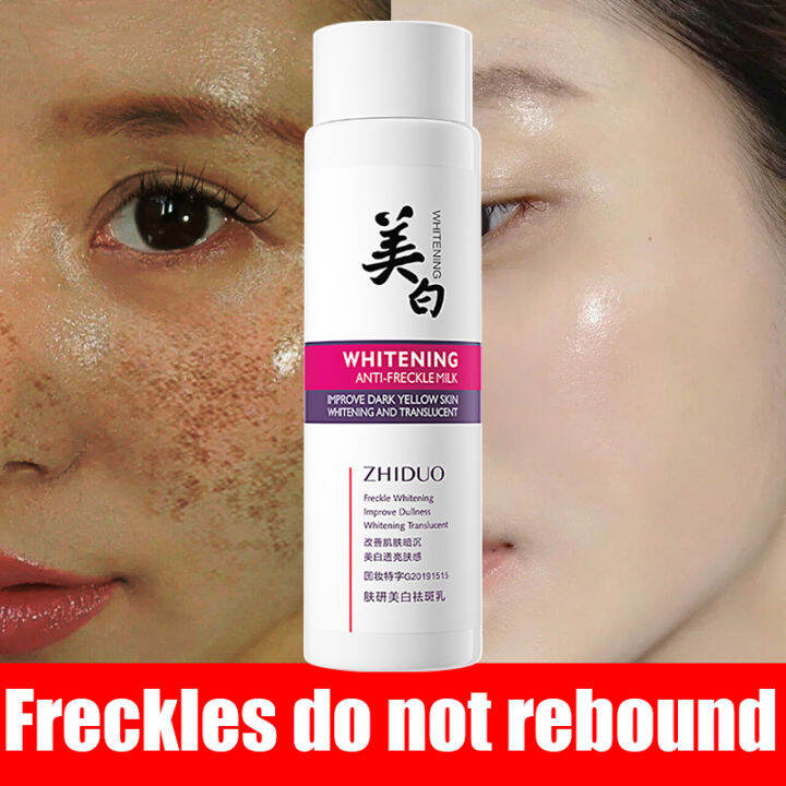 Days Effectiveeffective Whitening Freckle Cream Original