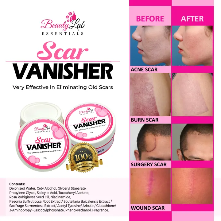 Beauty Lab Essentials Scar Vanisher G For Scar Marks Scar Remover