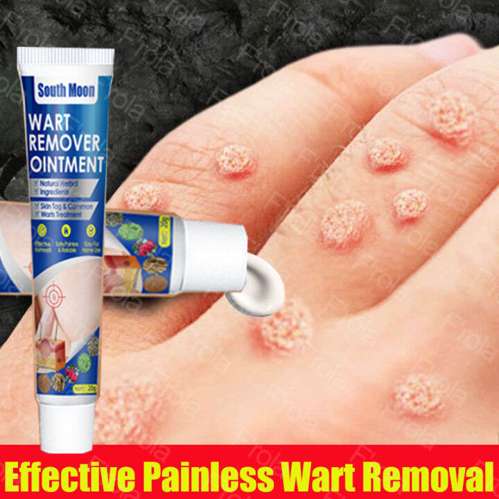 Painless Wart Remover Original Magic Ointment Wart Treatment Cream Skin