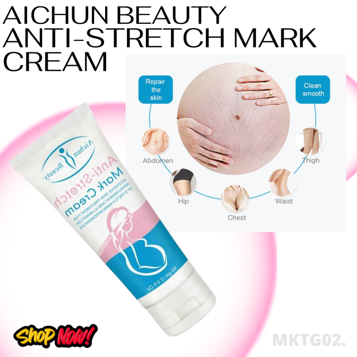 AICHUN BEAUTY Anti Stretch Mark Cream Lazada PH