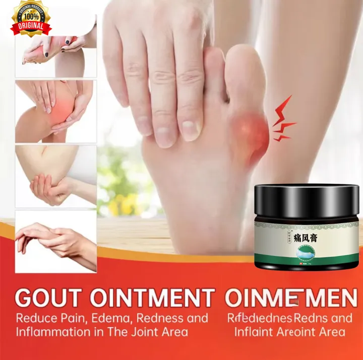 Natural Chinese Herbal Medicine Gout Ointment Gout Cream Tenosynovitis