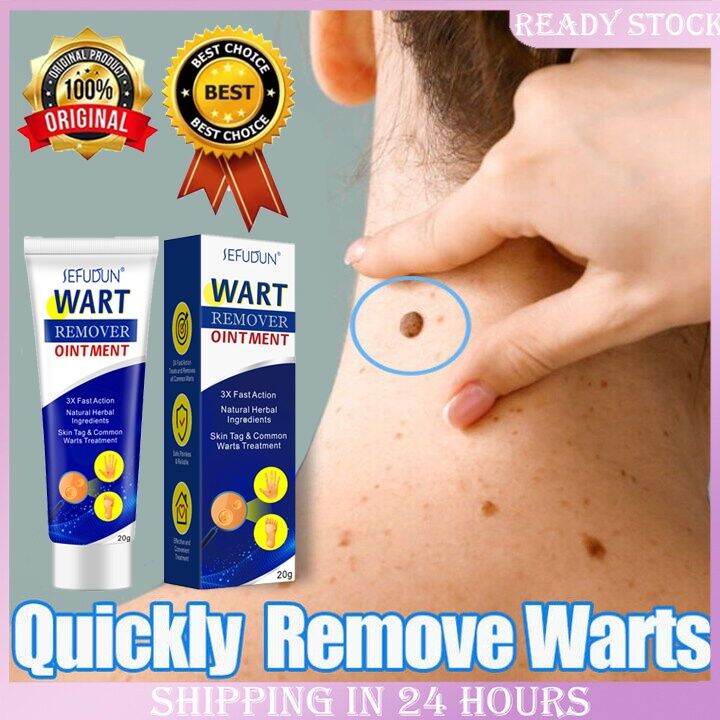 SEFUDUN Painless Warts Remover Ointment Cream Effectively Remove Skin