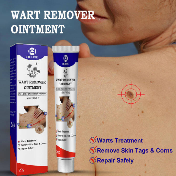 Dickco Dickco Wart Herpes Remover Ointment Skin Papillomas Genital Wart