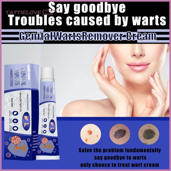 TATTIELOVE 20g Warts Remover Cream Skin Tag Remover Painless Wart