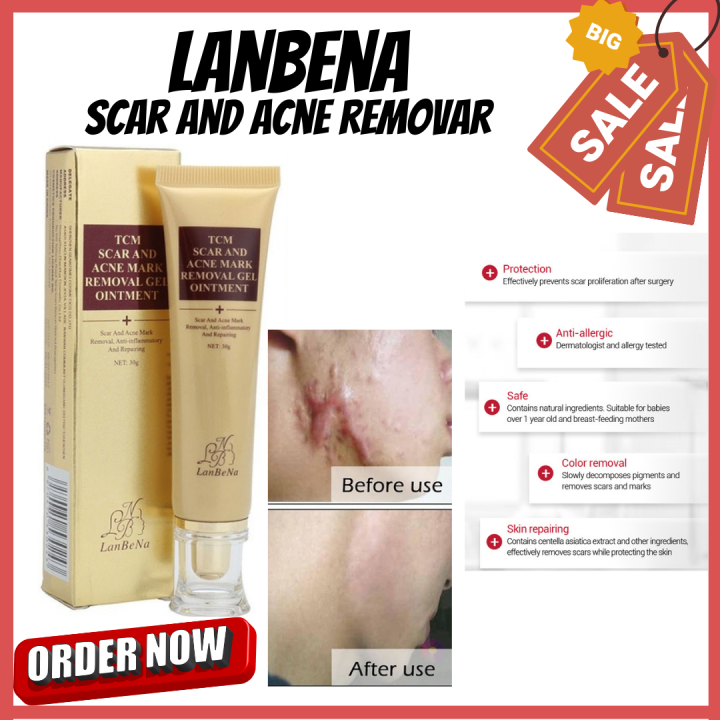 High Quality Lanbena Lanbena Scar And Acne Removal Original Tcm Acne