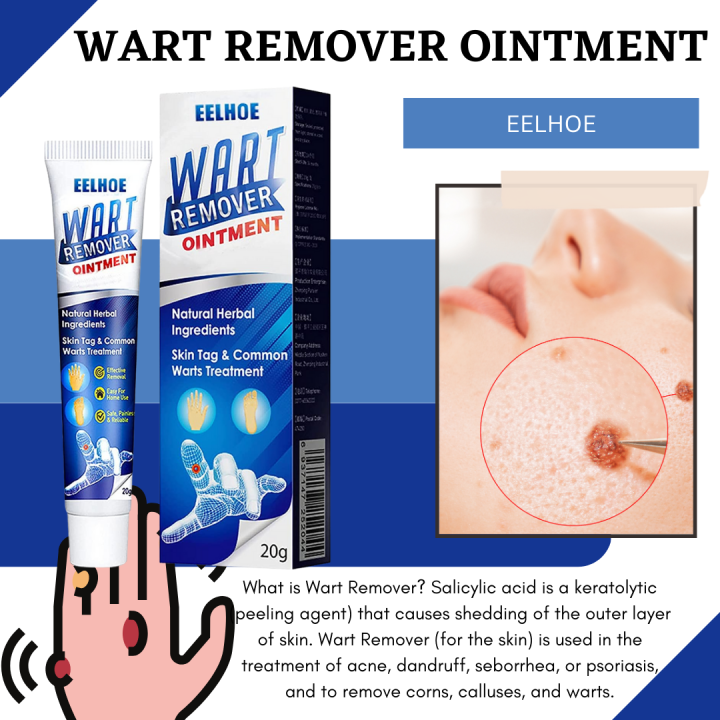 New Effective Wart Remover Ointment Skin Tag Remover Cream Natural