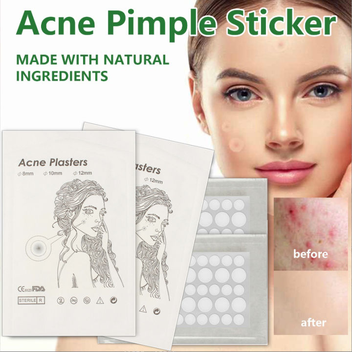 C Three Pcs Waterproof Acne Patch Blemish Treatment Skin Care Acne